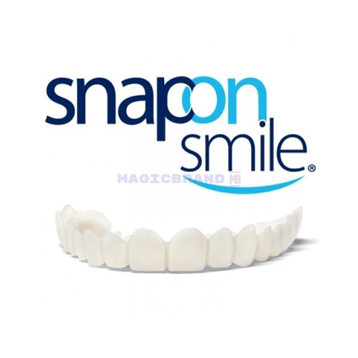 〚 Snap-On Smile 〛 〚 veneers 〛